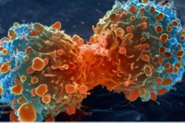 Більшість видів раку не пов`язані зі способом життя – вчені