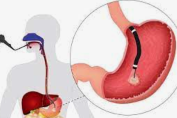 Ендоскопічні обстеження органів черевної порожнини